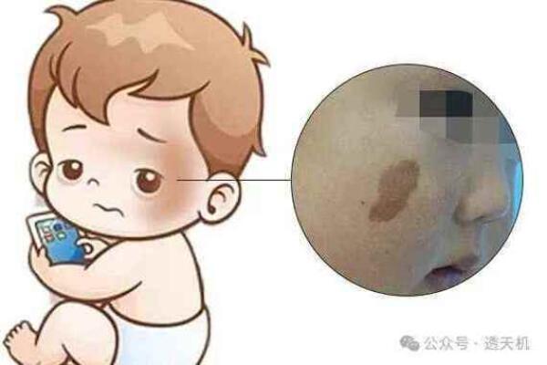 腿上不同位置的胎记算命