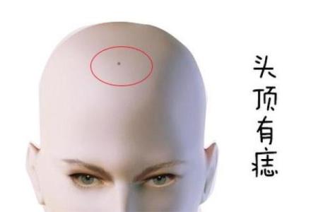 女人有观音痣好吗 命中贵人相助化险为夷