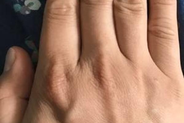 算命说邪骨病是真是假