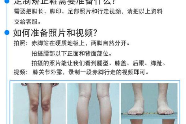 八字型腿