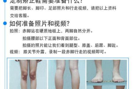 八字型腿