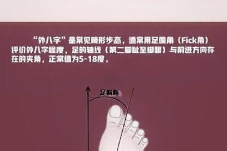 外八字轮