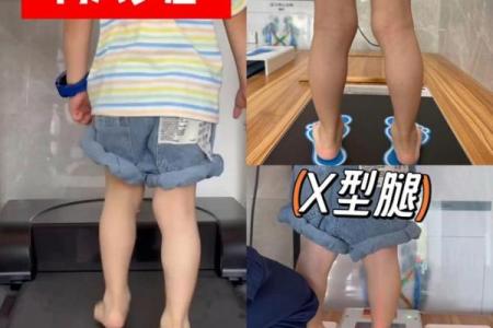 内八字腿